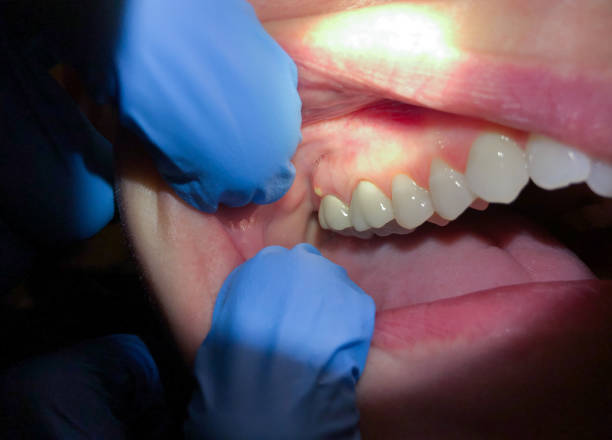 Best Pediatric Emergency Dentist in Salem, VA