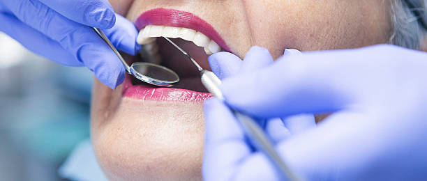 Best Emergency Dentist for Special Needs Patients in Salem, VA